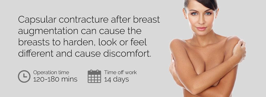 Capsular Contracture Surgery