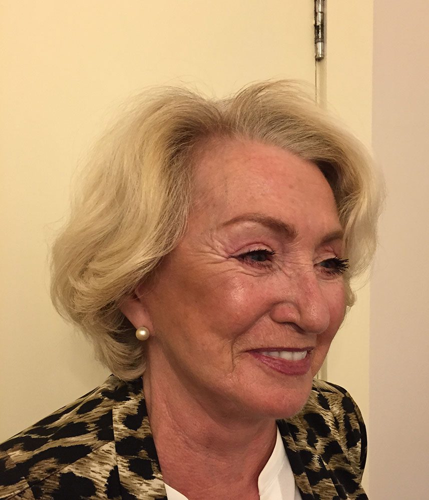 Redo short scar facelift patient 1 after right oblique