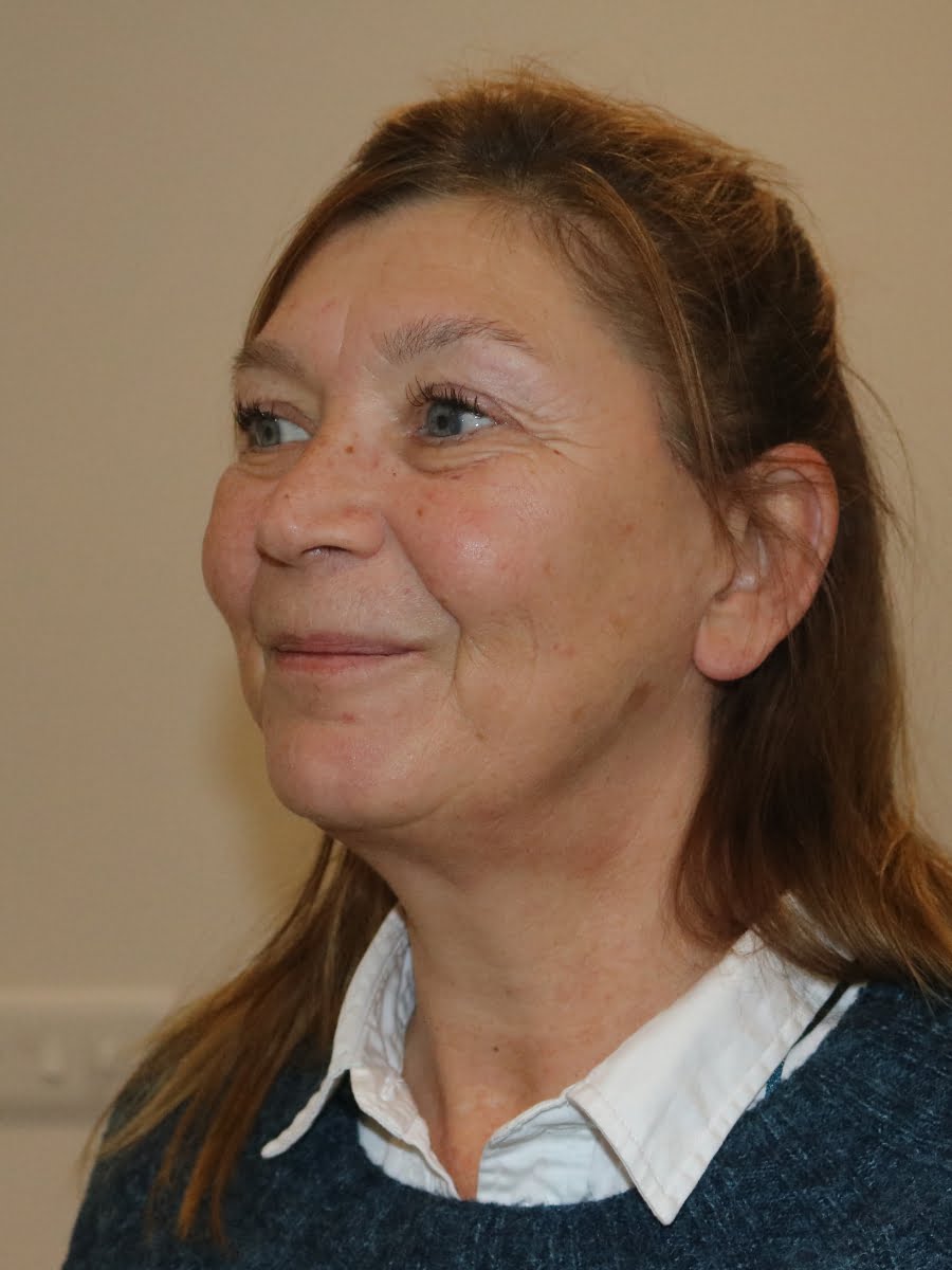 Facelift necklift after surgery left oblique