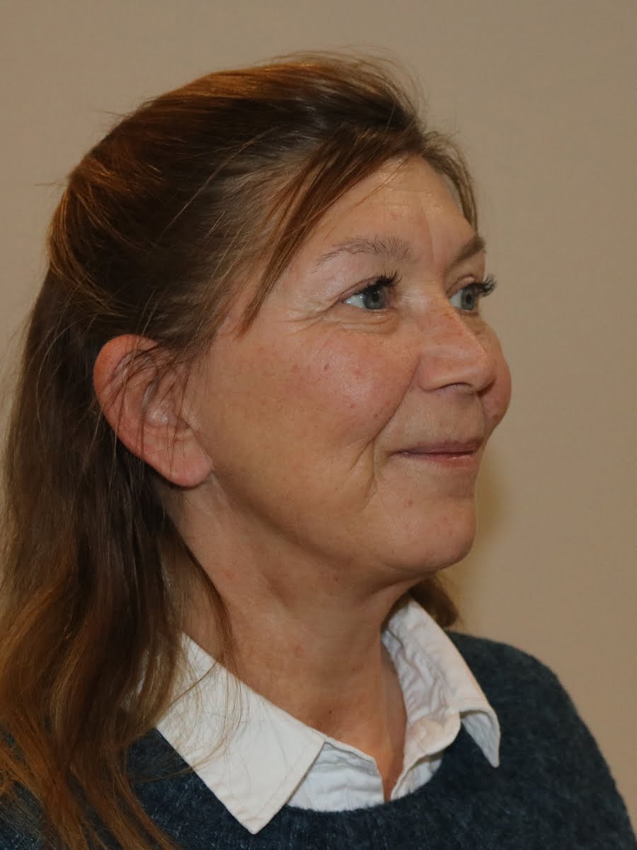 Facelift necklift after surgery right oblique