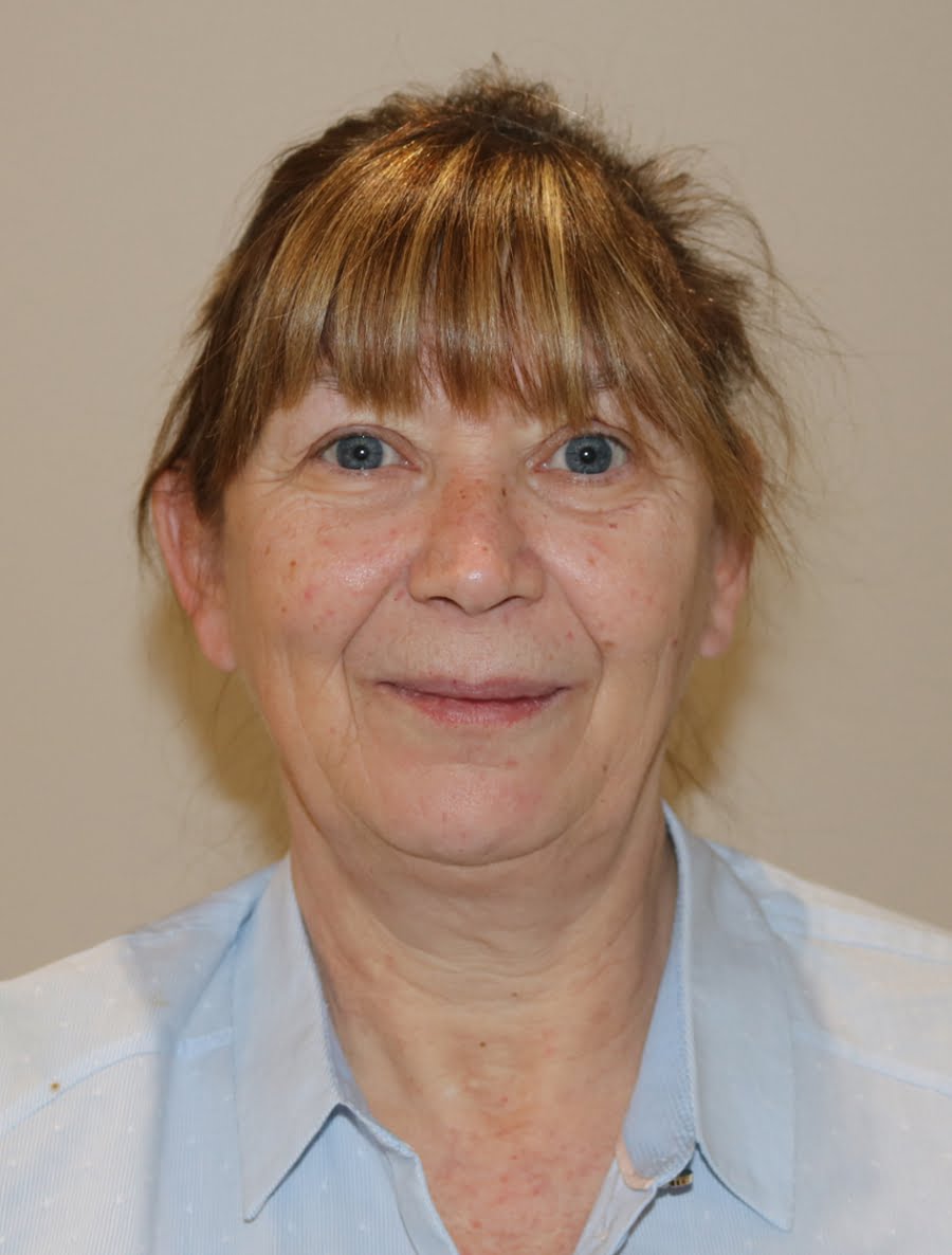 Facelift necklift before surgery AP view