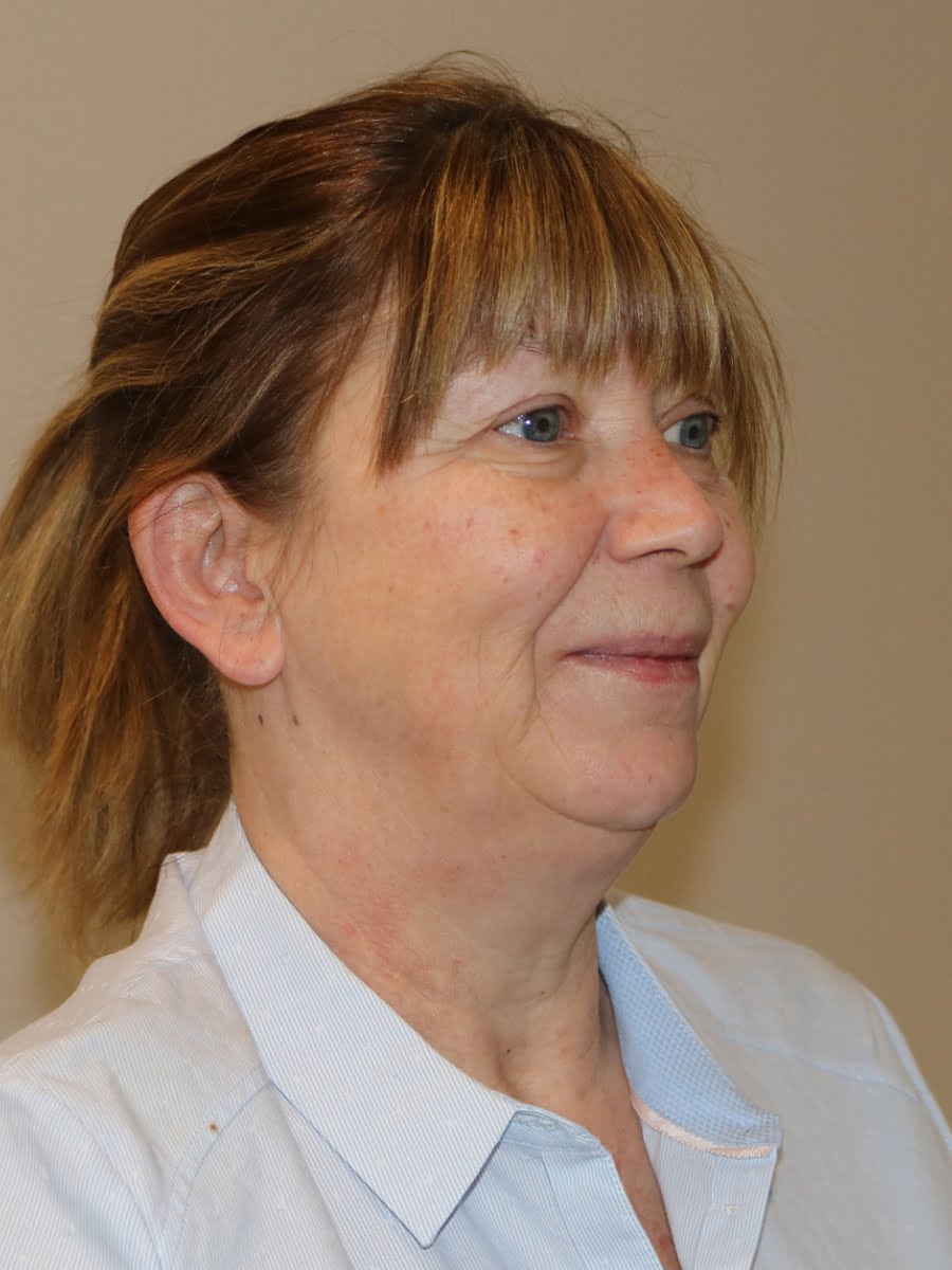 Facelift necklift before surgery right oblique