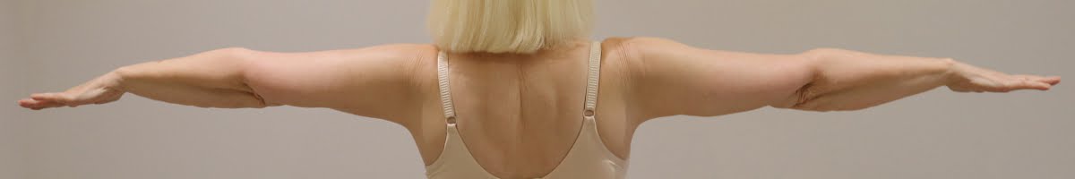 Arm lift brachioplasty posterior view after surgery