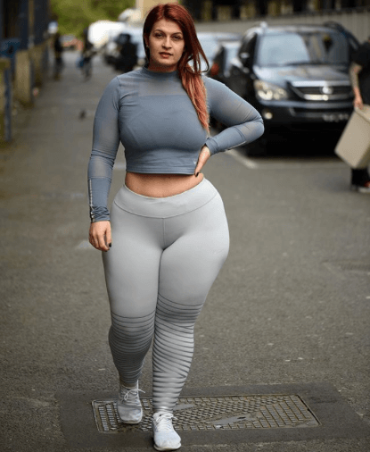 Ioana Chora - Instagram Lipoedema Story