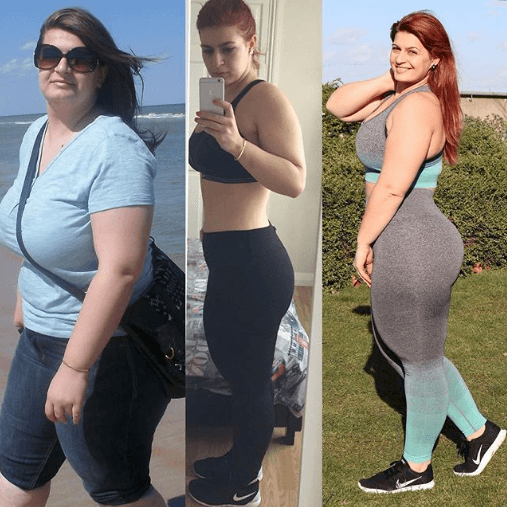 Ioana Chira - Lipoedema Story 