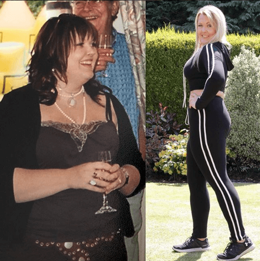 Karen Windsor - Lipoedema Story